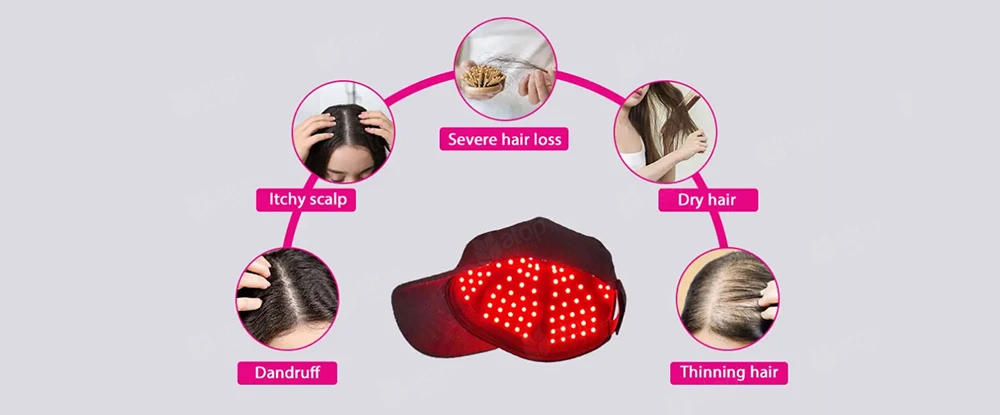 red light therapy cap improve hair health